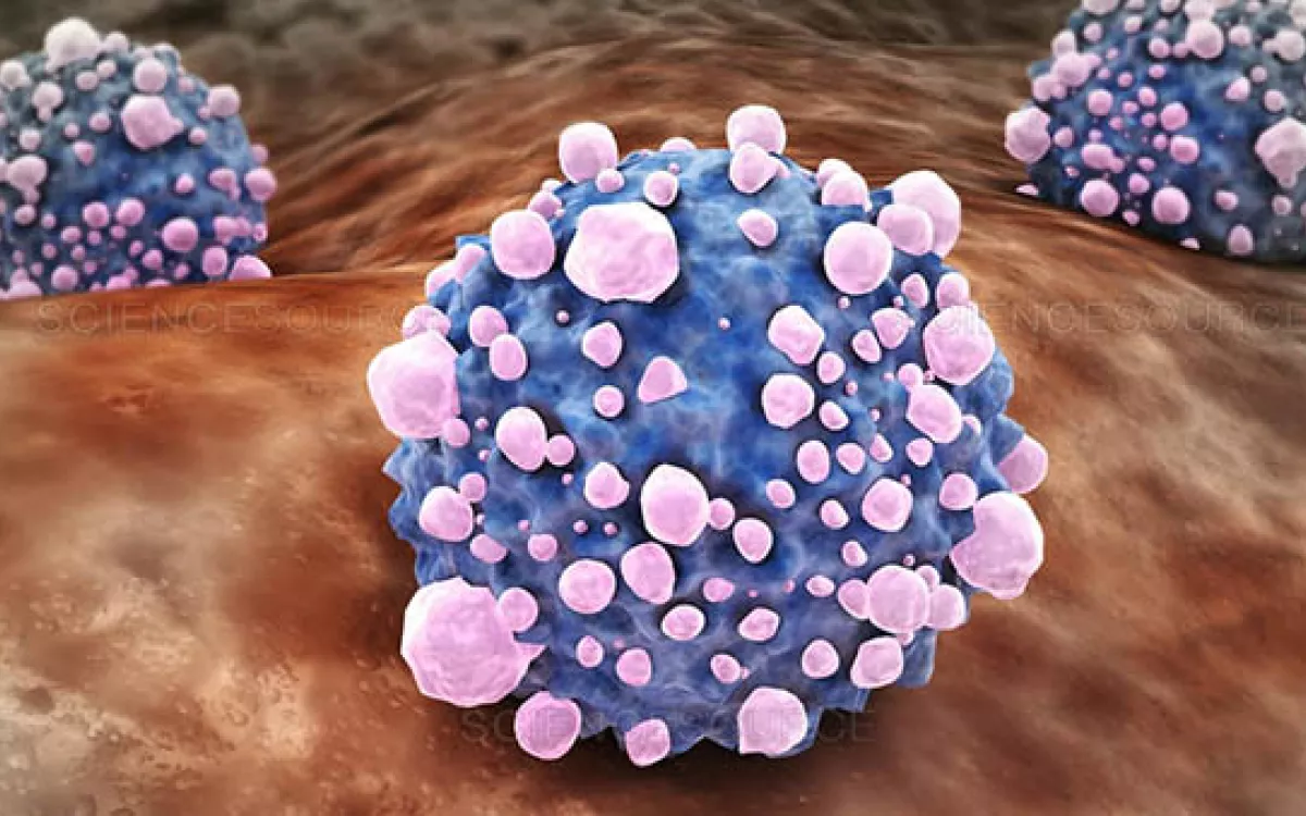Un proyecto de Precipita busca nuevas terapias contra el cáncer de páncreas